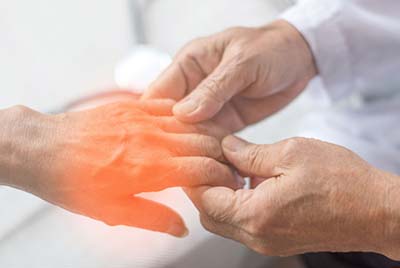 Physio for Arthritis