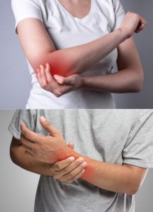 Elbow & Wrist Pain Treatment